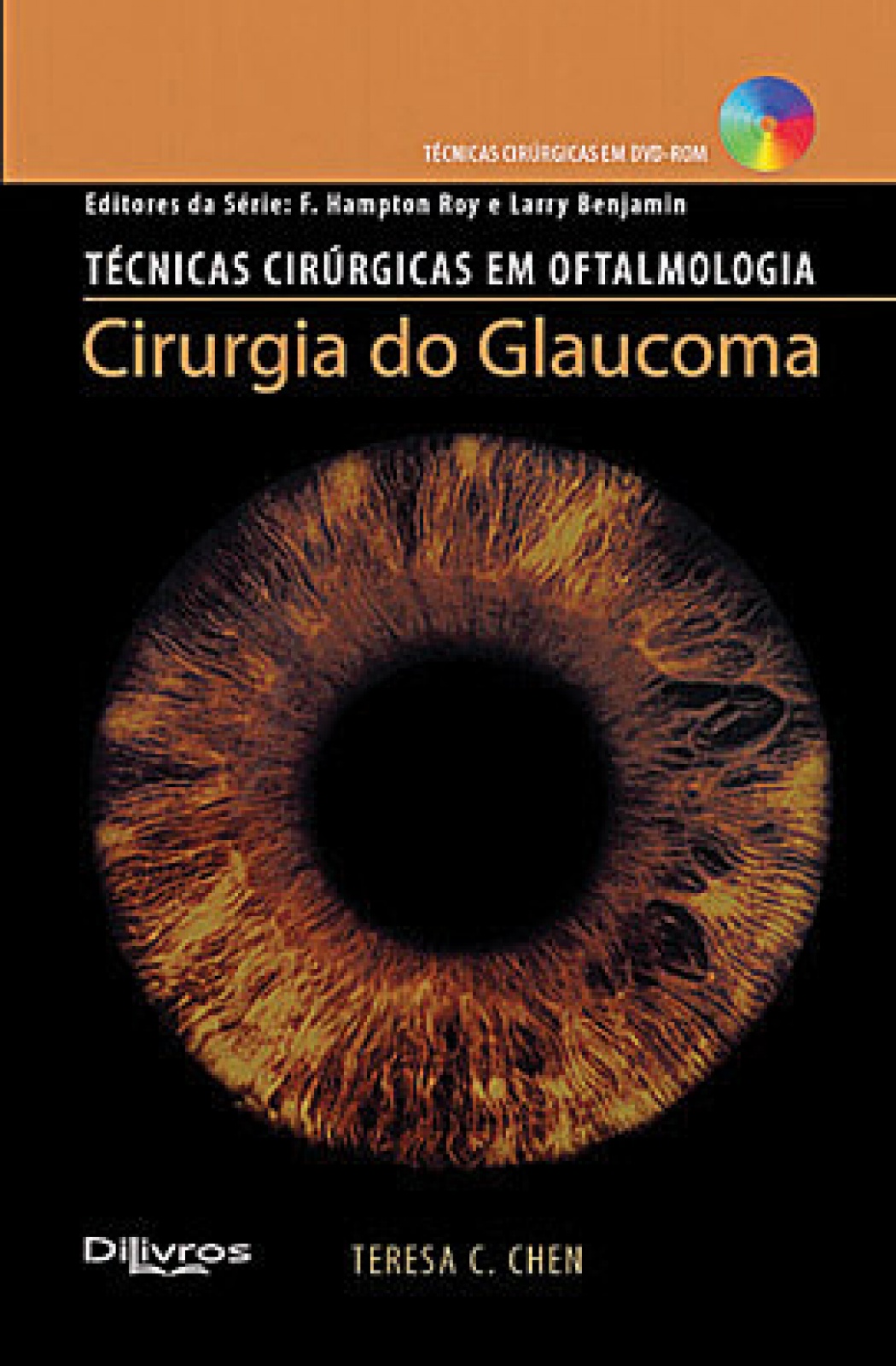 Cirurgia Do Glaucoma Doctor Livros Um Incentivo Atualiza O