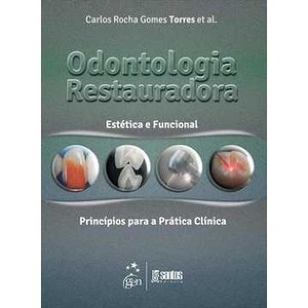 Odontologia Restauradora Estética E Funcional