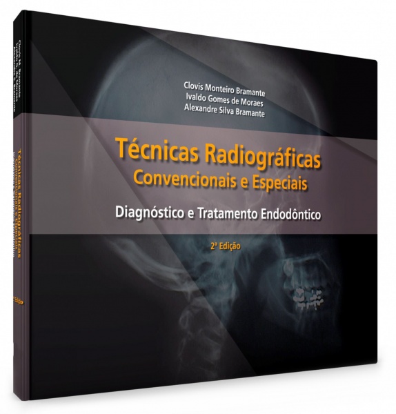 Técnicas Radiograficas Convencionais E Especiais