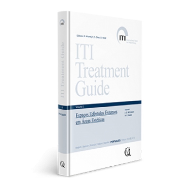 Iti Treatment Guide, Vol 6: Espaços Edêntulos Extensos Em Áreas Estéticas