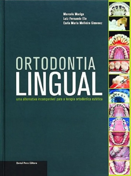 Ortodontia Lingual
