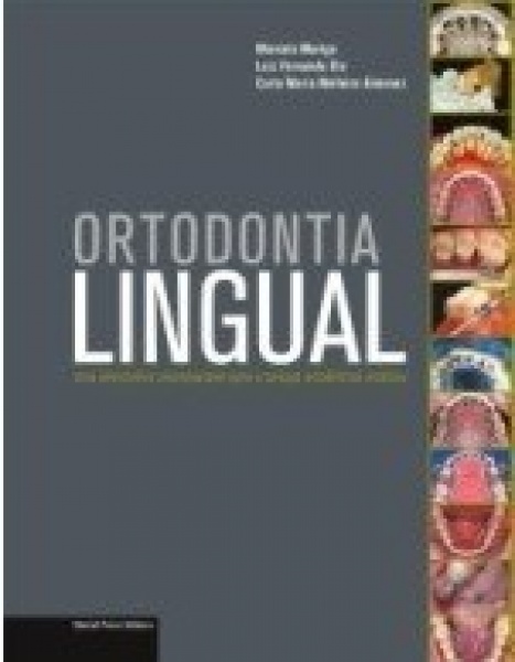 Ortodontia Lingual