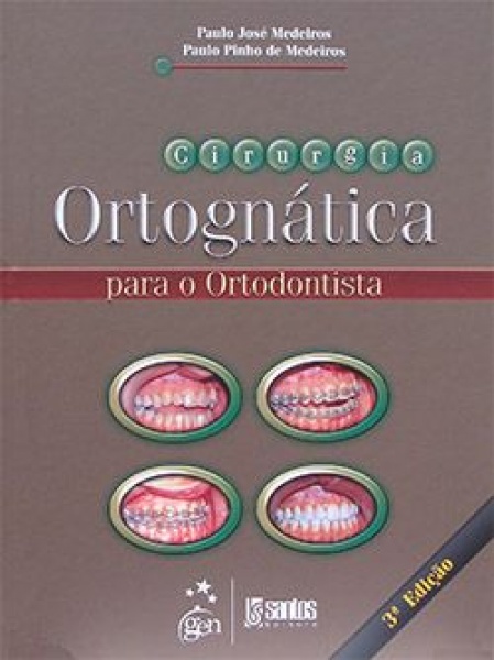 Cirurgia Ortognática Para O Ortodontista