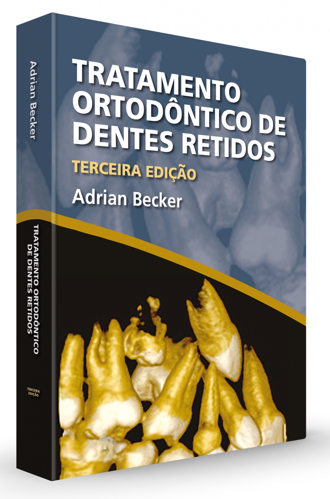 Tratamento Ortodôntico De Dentes Retidos