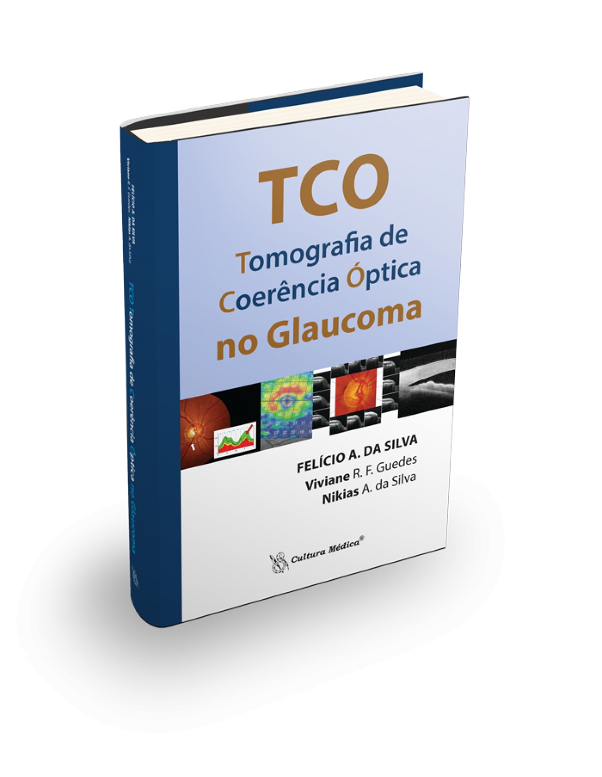 Tco Tomografia De Coerência Óptica No Glaucoma 1.ed