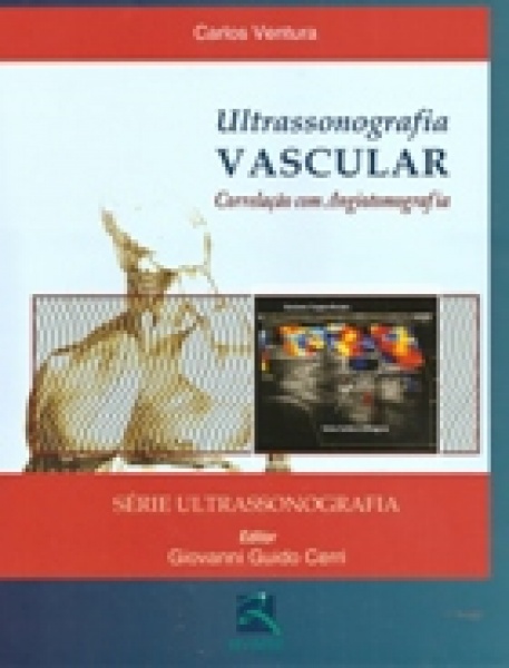 Ultrassonografia Vascular