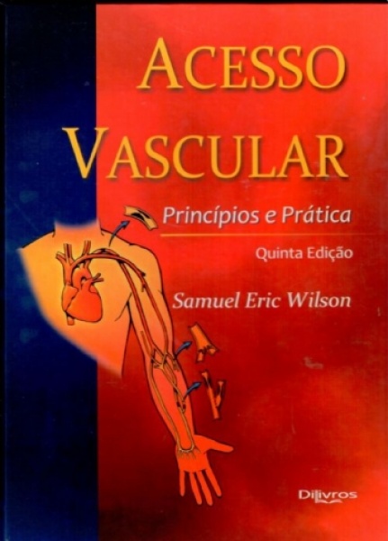 Acesso Vascular - Princípios E Prática