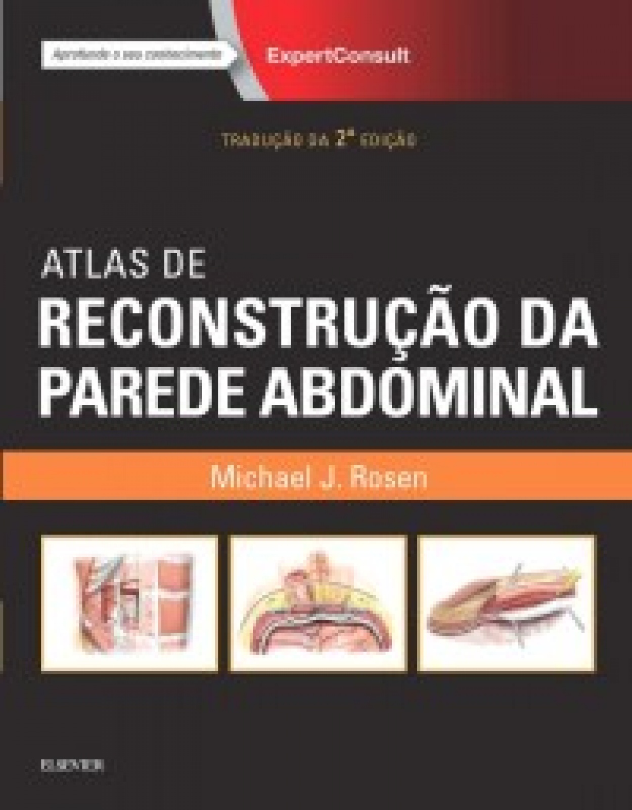 Atlas De Reconstrução Da Parede Abdominal- 2A Edição