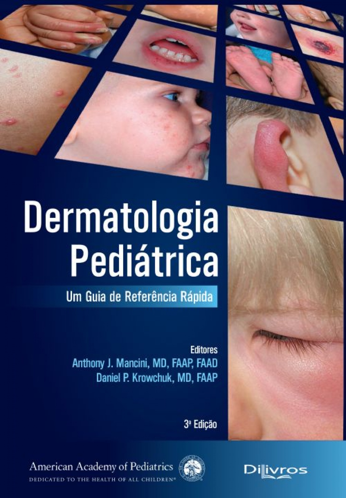 Dermatologia Pediatrica