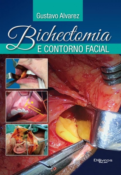 Bichectomia E Contorno Facial