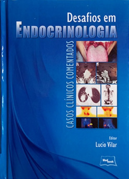 Desafios Em Endocrinologia - Casos Clínicos Comentados