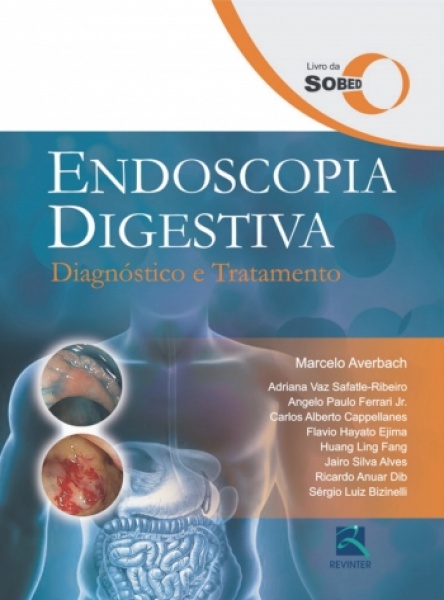 Endoscopia Digestiva - Diagnostico E Tratamento