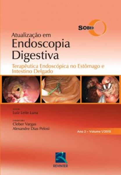 Atualização Em Endoscopia Digestiva  - Terapêutica Endoscópica No Estômago E Intestino Delgado
