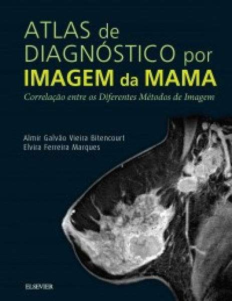 Atlas De Diagnóstico Por Imagem De Mama- 1A Edição