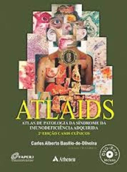 Atlaids - Atlas De Patologia Da Síndrome Da Imunodeficiência Adquirida (Aids/hiv) 2A Edição – Casos Clínicos