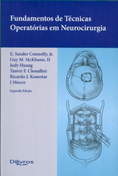 Fundamentos De Técnicas Operatórias Em Neurocirurgia