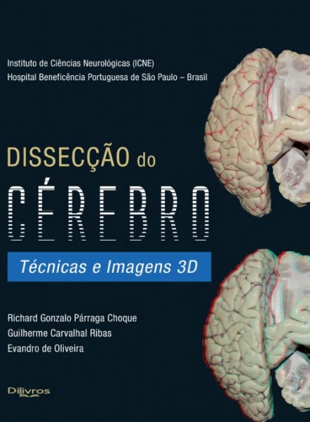 Dissecção Do Cérebro  Técnicas E Imagens 3D