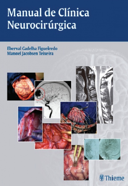 Manual De Clínica Neurocirúrgica