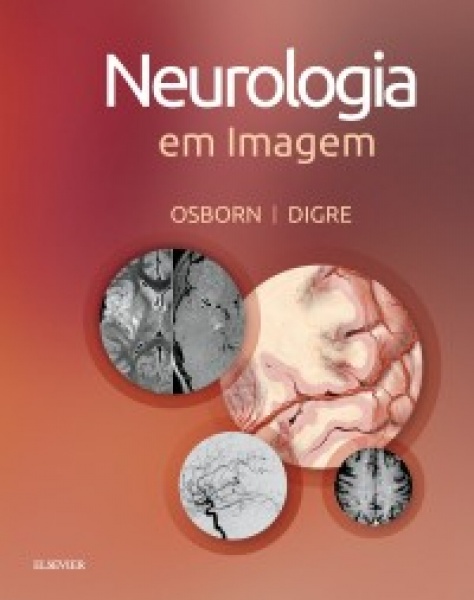 Neurologia Em Imagem- 1A Edição