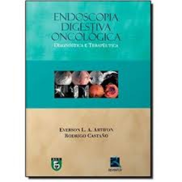 Endoscopia Digestiva Oncológica Diagnóstica E Terapêutica