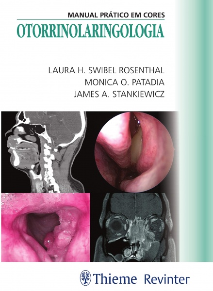 Otorrinolaringologia - Manual Prático Em Cores