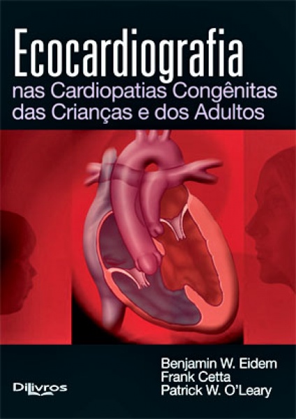 Ecocardiografia Nas Cardiopatias Congênitas Das Crianças E Dos Adultos