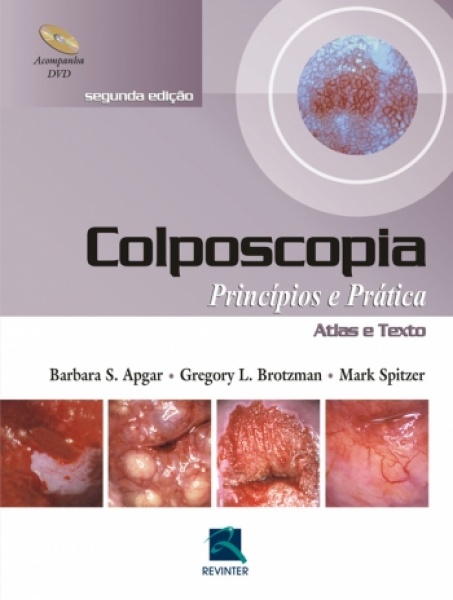 Colposcopia - Princípios E Prática - Atlas E Texto - Acompanha Dvd