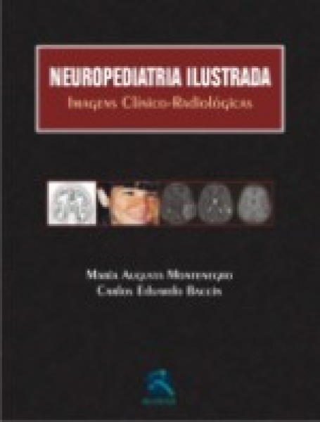 Neuropediatria Ilustrada - Imagens Clínico-Radiológicas