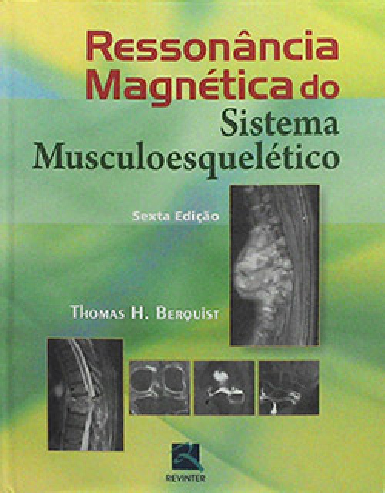 Ressonância Magnética Do Sistema Musculoesquelético