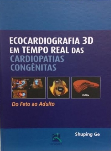 Ecocardiografia 3D Em Tempo Real Das Cardiopatias Congênitas Do Feto Do Ao Adulto
