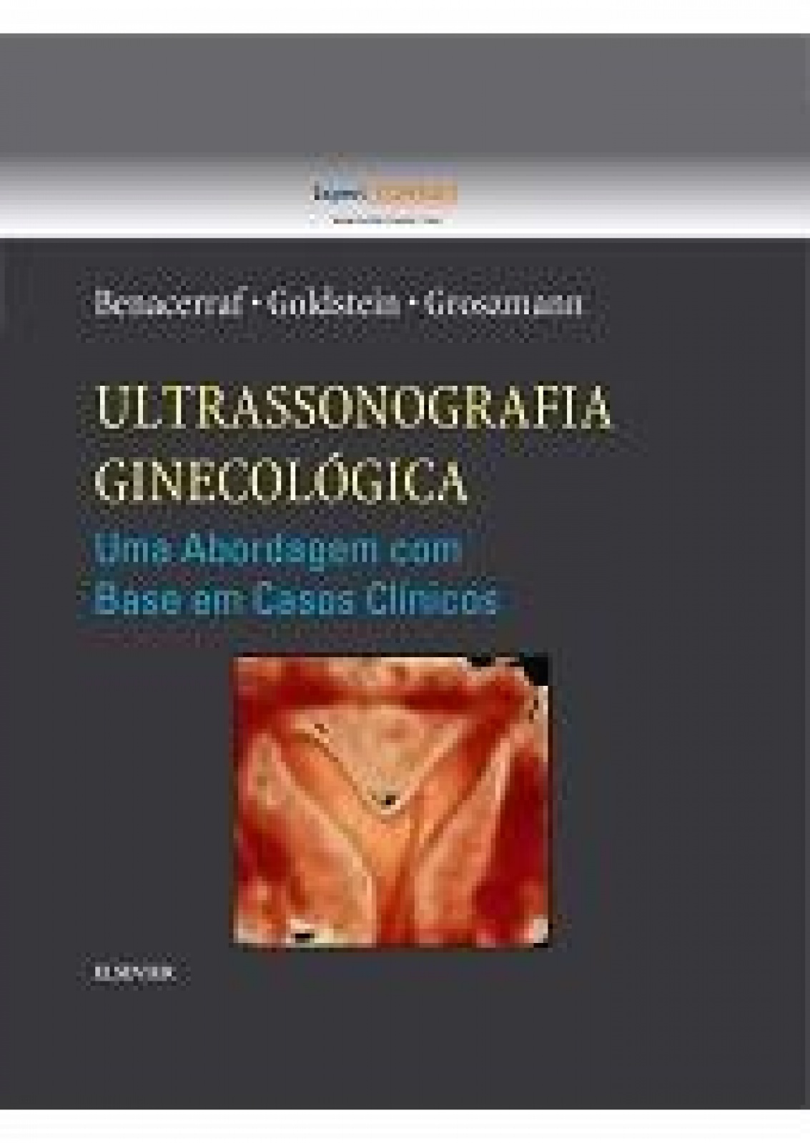 Ultrassonografia Ginecológica - 1ª Edição 2016