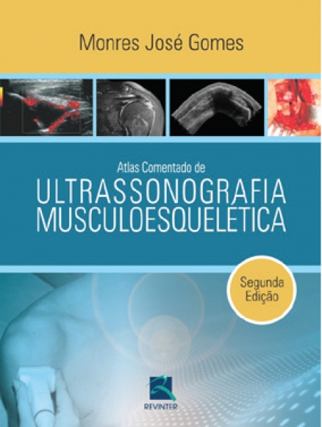 Atlas Comentado De Ultrassonografia Musculoesquelética, 2ª Edição