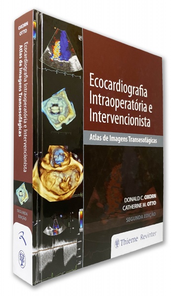 Ecocardiografia Intraoperatória E Intervencionista - Atlas De Imagens Transesofágicas