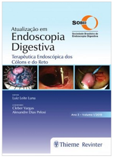 Atualização Em Endoscopia Digestiva – Terapêutica Endoscópica Dos Cólons E Do Reto