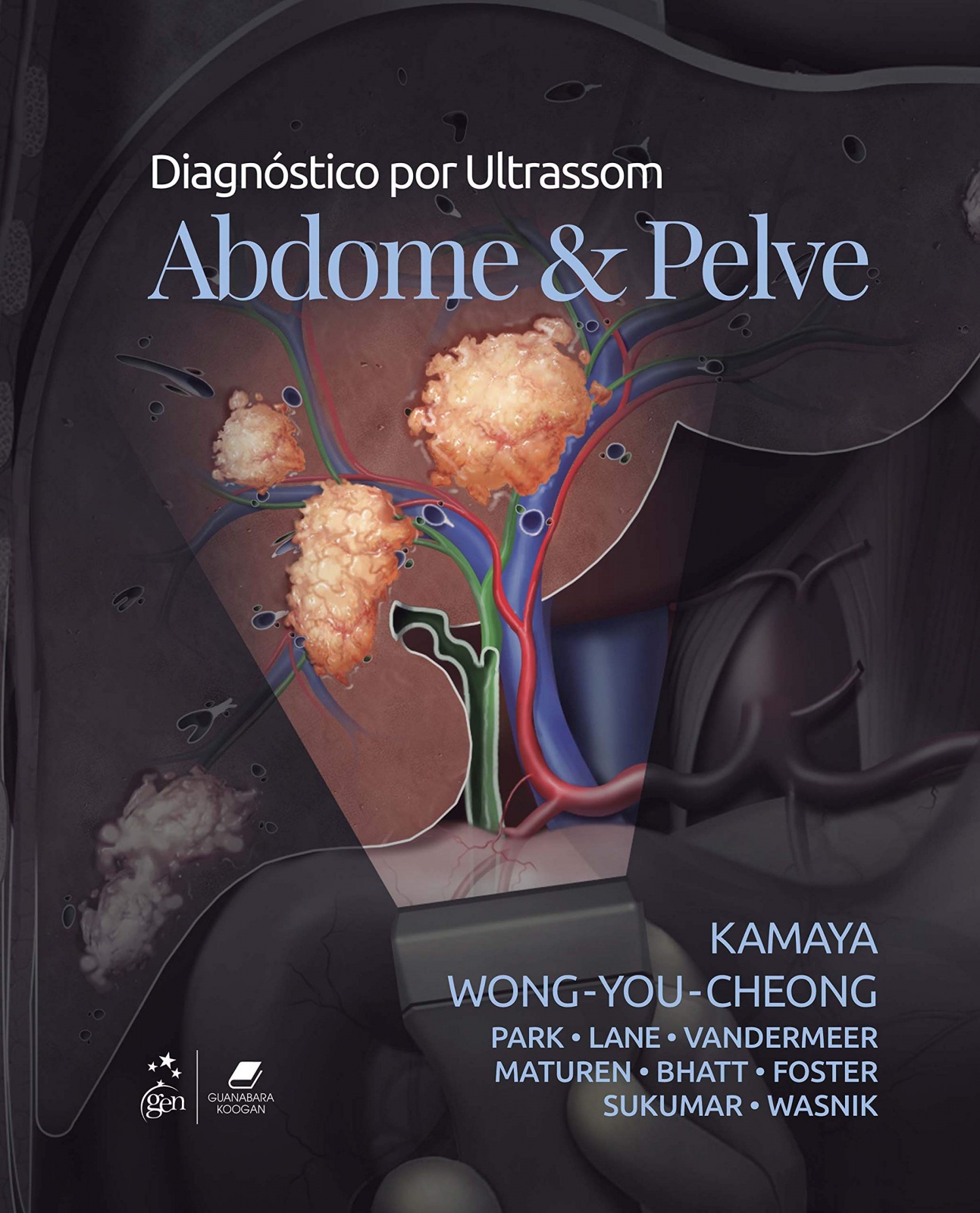 Diagnostico Por Ultrassom: Abdome E Pelve - 1A Edição