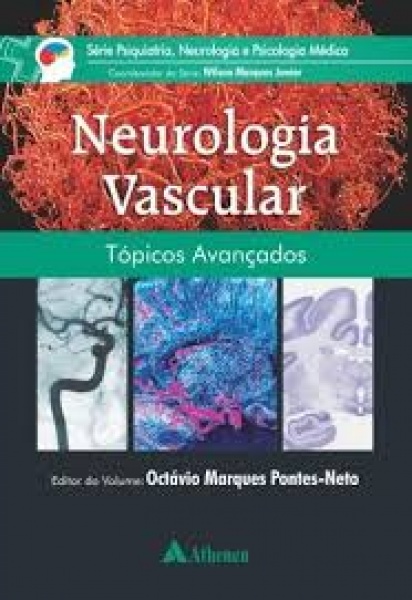 Neurologia Vascular - Tópicos Avançados