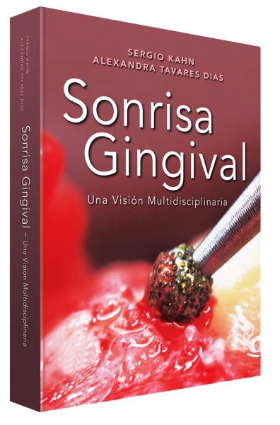 Sonrisa Gingival - Una Vision Multidiciplinaria