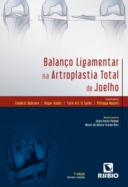 Balanço Ligamentar na Artroplastia Total de Joelho