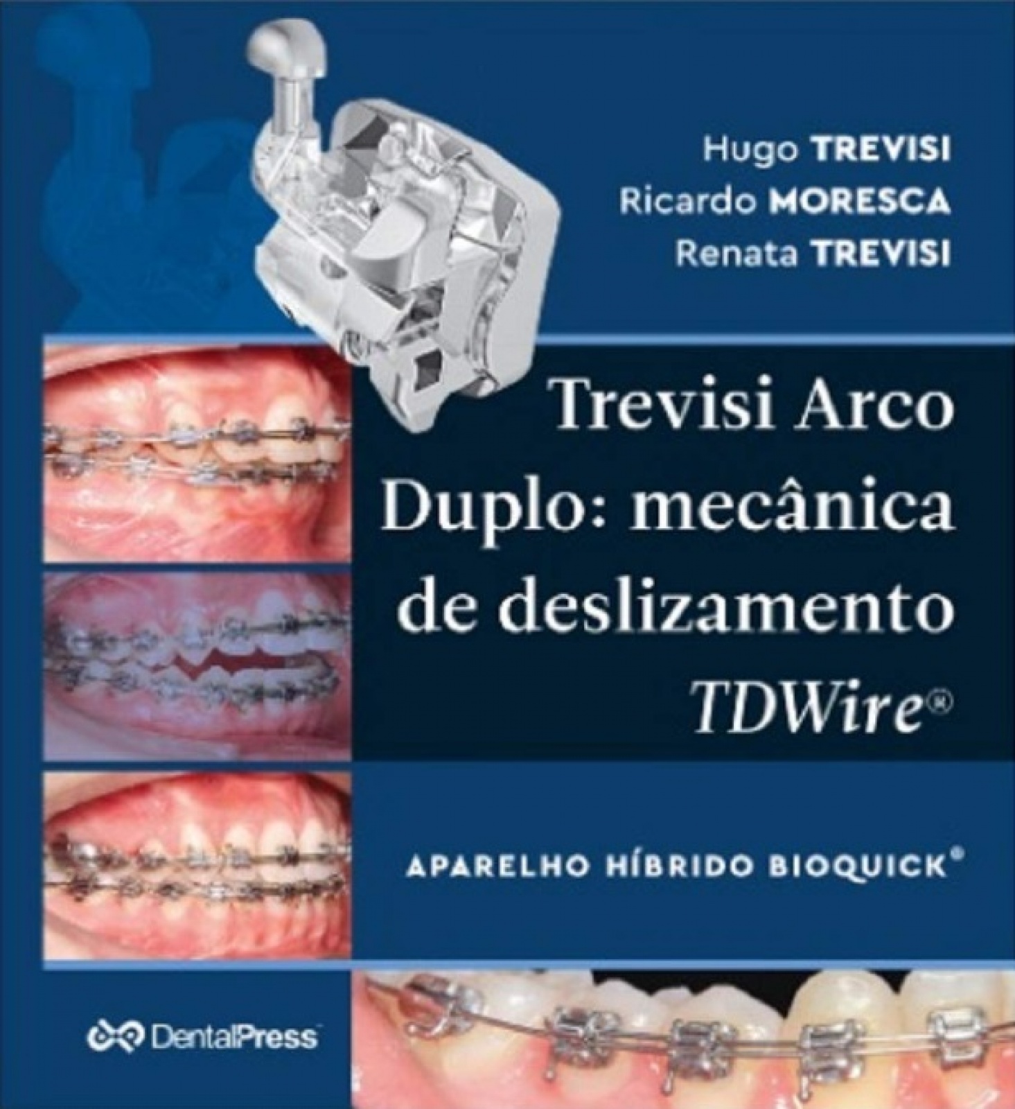 Trevisi - Arco Duplo - Mecanica De Deslizamento - Tdwire
