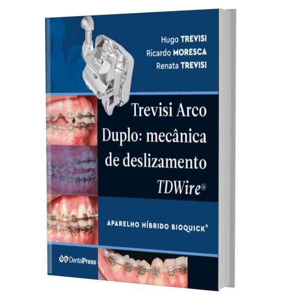 Trevisi - Arco Duplo - Mecanica De Deslizamento - Tdwire 