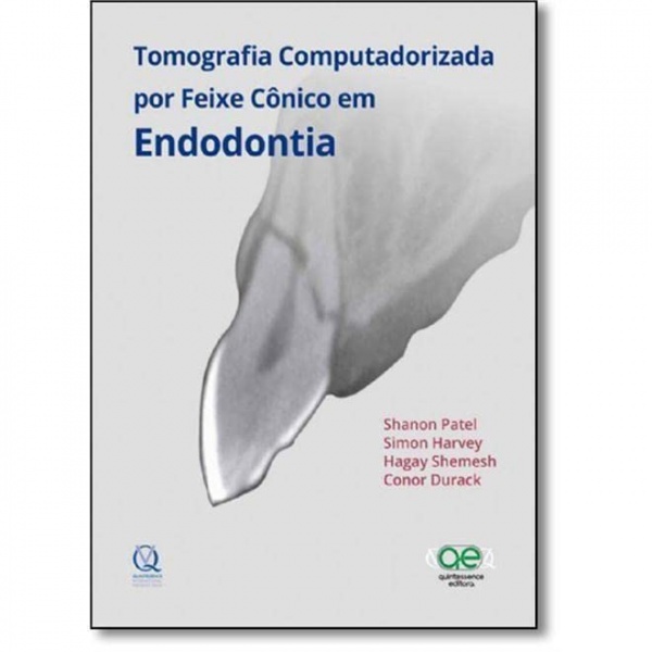 Tomografia Computadorizada Por Feixe Cônico Em Endodontia