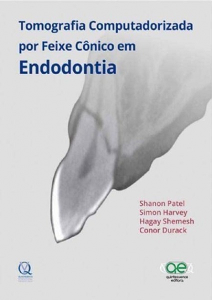 Tomografia Computadorizada Por Feixe Cônico Em Endodontia