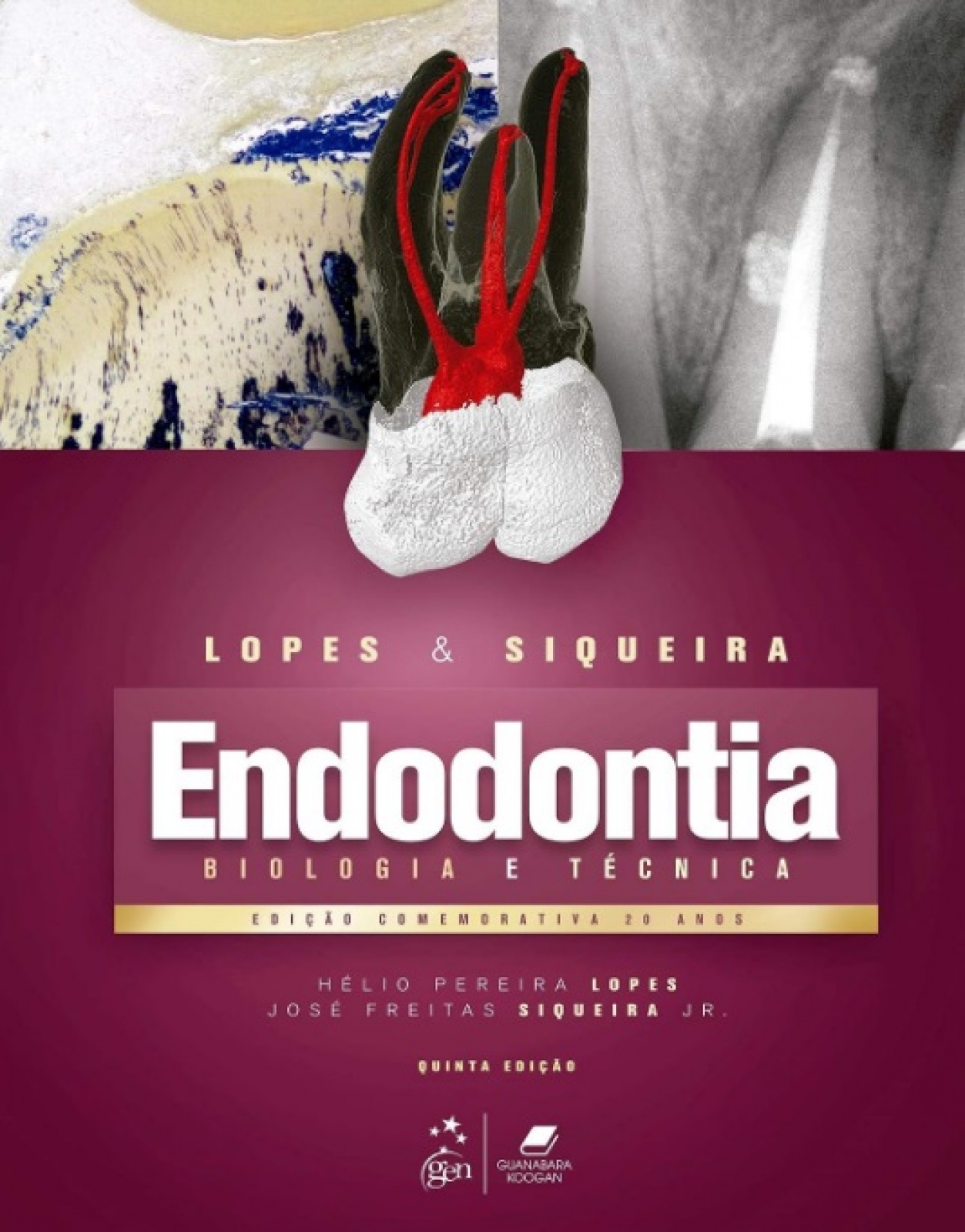 Endodontia - Biologia E Técnica