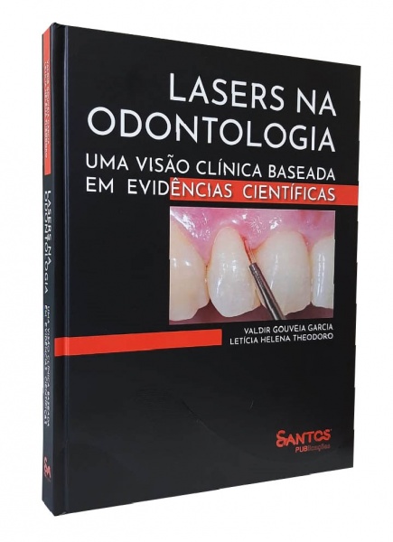 Lasers Na Odontologia • Uma Visão Clínica Baseada Em Evidências Científicas