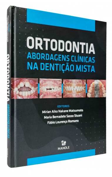 Ortodontia - Abordagens Clínicas Na Dentição Mista