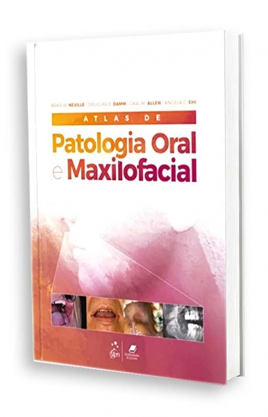 Atlas De Patologia Oral E Maxilofacial