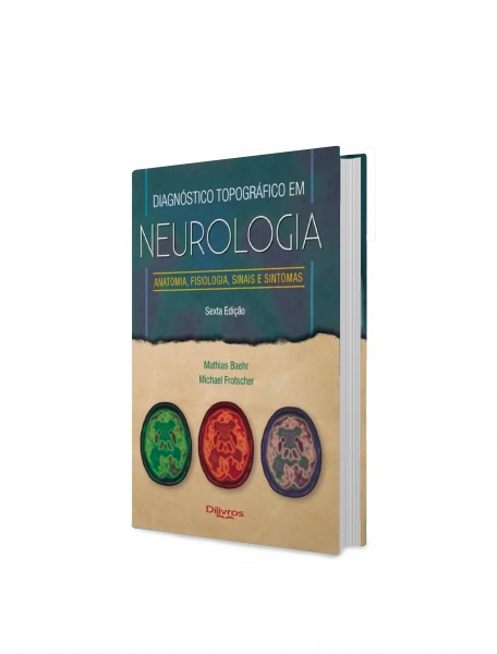 Diagnóstico Topográfico Em Neurologia
