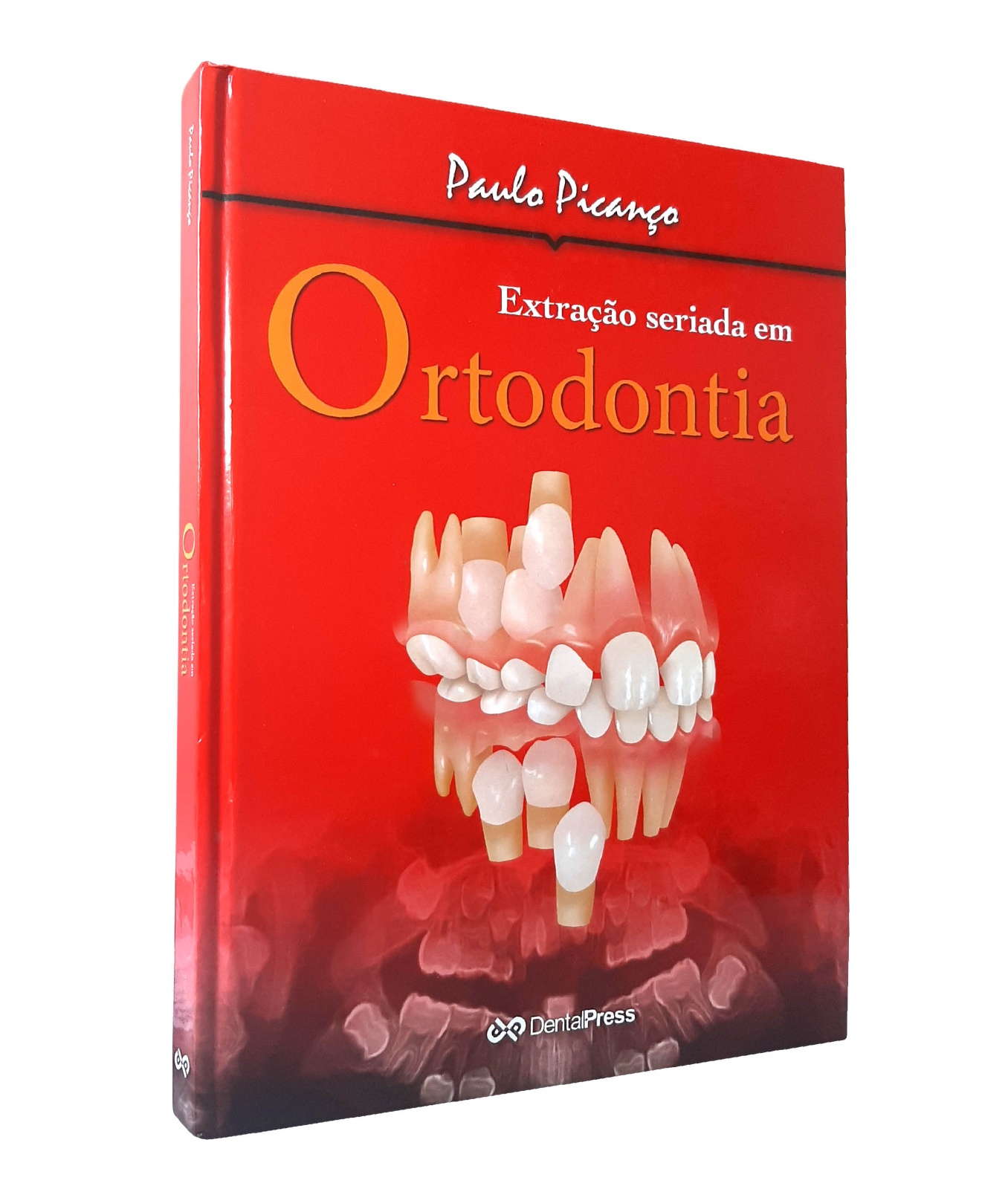Extração Seriada Na Ortodontia