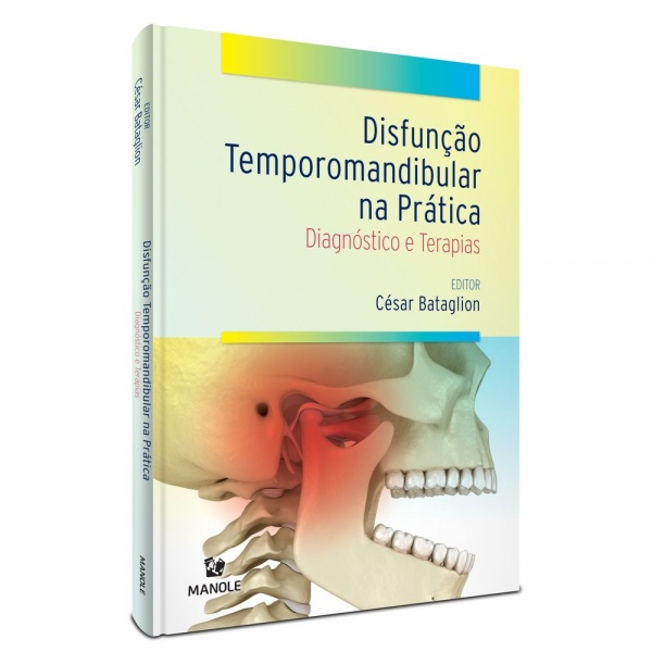 Disfunção Temporomandibular Na Prática - Diagnóstico E Terapias 