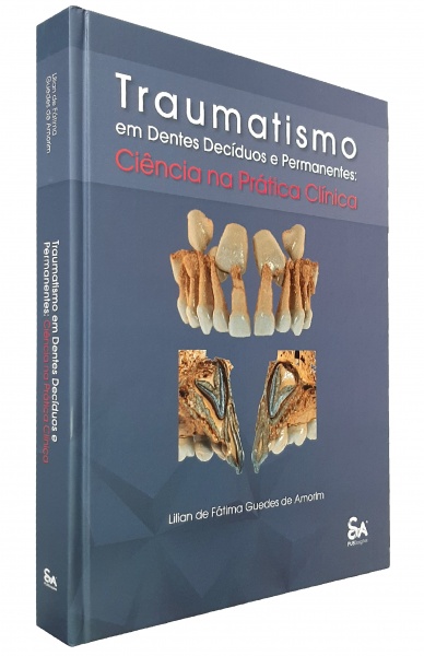 Traumatismo Em Dentes Decíduos E Permanentes - Ciência Na Prática Clínica